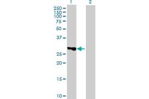 Western Blot analysis of TBC1D7 expression in transfected 293T cell line by TBC1D7 MaxPab polyclonal antibody. (TBC1D7 anticorps  (AA 1-293))