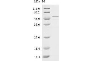 (Tris-Glycine gel) Discontinuous SDS-PAGE (reduced) with 5 % enrichment gel and 15 % separation gel.