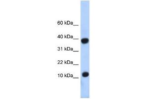 WB Suggested Anti-PCBD1 Antibody Titration:  0. (PCBD1 anticorps  (N-Term))