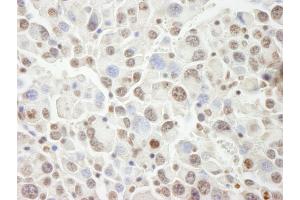 Immunohistochemistry (IHC) image for anti-PHD Finger Protein 6 (PHF6) (AA 125-175) antibody (ABIN7448999) (PHF6 anticorps  (AA 125-175))