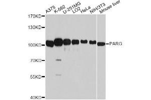 Western blot analysis of extracts of various cell lines, using PARG antibody (ABIN5998452) at 1:7000 dilution.