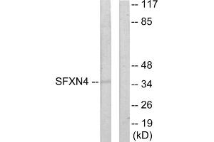 Western blot analysis of extracts from HUVEC cells, using SFXN4 antibody. (Sideroflexin 4 anticorps  (N-Term))