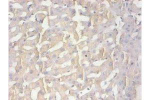 Immunohistochemical of paraffin-embedded human liver tissue using ABIN7165035 at dilution of 1:200 (AMBP anticorps)