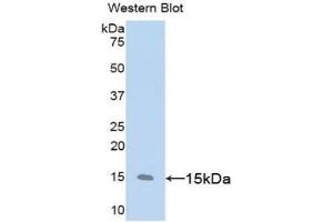 Detection of Recombinant CD59, Rat using Polyclonal Antibody to Cluster of Differentiation 59 (CD59) (CD59 anticorps  (AA 23-105))