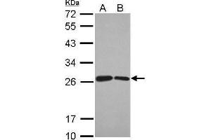 WB Image Sample (30 ug of whole cell lysate) A: Jurkat B: Raji 12% SDS PAGE antibody diluted at 1:1000 (BUD31 anticorps)