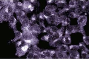 Immunofluorescence staining of ES-2 cells (Human ovary clear cell carcinoma, ATCC CRL-1978). (GOLGA5 anticorps  (AA 510-713))