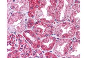 Immunohistochemistry (IHC) image for anti-Signal Transducer and Activator of Transcription 3 (Acute-Phase Response Factor) (STAT3) (N-Term) antibody (ABIN2780479)