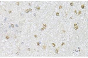 Immunohistochemistry of paraffin-embedded Mouse brain using CMAS Polyclonal Antibody at dilution of 1:150 (40x lens). (CMAS anticorps)