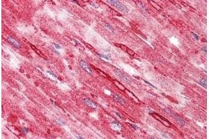 Human Heart: Formalin-Fixed, Paraffin-Embedded (FFPE) (TTYH2 anticorps  (N-Term))