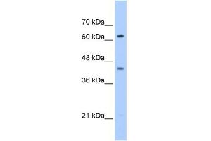 WB Suggested Anti-ZSCAN5D Antibody Titration:  0. (ZSCAN5D anticorps  (Middle Region))