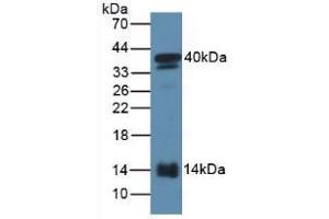 Figure. (SAA2 anticorps  (AA 20-122))
