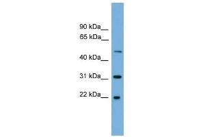 CRYBA4 antibody used at 0. (CRYbA4 anticorps  (Middle Region))