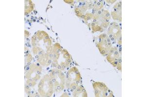 Immunohistochemistry of paraffin-embedded human stomach using C1 antibody (ABIN3016169, ABIN3016170, ABIN3016171 and ABIN6219598) at dilution of 1:100 (40x lens). (ATP2C1 anticorps  (AA 400-660))