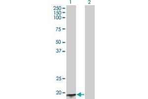Western Blot analysis of ACYP2 expression in transfected 293T cell line by ACYP2 monoclonal antibody (M06), clone 2H7.