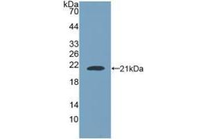 Detection of Recombinant NUP210, Human using Polyclonal Antibody to Nuclear Pore Glycoprotein 210 (gp210)