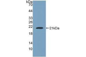 Detection of Recombinant NUP210, Human using Polyclonal Antibody to Nuclear Pore Glycoprotein 210 (gp210) (Nuclear Pore Glycoprotein 210 (AA 1288-1449) anticorps)
