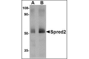Western blot analysis of Spred2 in human small intestine tissue lysate with this product at (A) 1 and (B) 2 μg/ml.