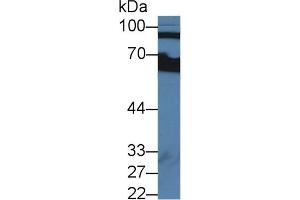 Western blot analysis of Human Serum, using Human CFB Antibody (2 µg/ml) and HRP-conjugated Goat Anti-Rabbit antibody ( (Complement Factor B anticorps  (AA 35-160))