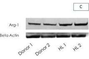 Arg-1 expression in neutrophils and lymph-node microenvironmentNeutrophils isolated from control and HL patients were analysed for Arg-1 expression (A), activity by measuring urea (B) and protein expression by Western Blot (C).