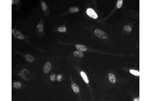 Immunofluorescent staining of HeLa (ATCC CCL-2) cells.