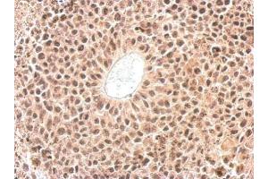 IHC-P Image Cyclophilin E antibody detects PPIE protein at nucleus on HeLa xenograft by immunohistochemical analysis.