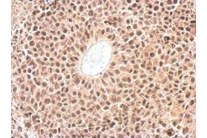 IHC-P Image Cyclophilin E antibody detects PPIE protein at nucleus on HeLa xenograft by immunohistochemical analysis.