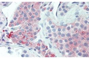 Detection of UCN2 in Human Testis Tissue using Polyclonal Antibody to Urocortin 2 (UCN2) (Urocortin 2 anticorps  (AA 20-112))