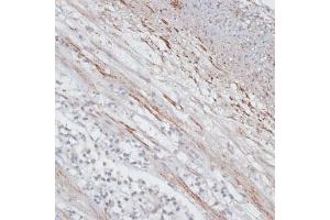 Immunohistochemistry of paraffin-embedded human appendix using Tropomyosin 1 antibody (ABIN3021577, ABIN3021578, ABIN3021579, ABIN1513635 and ABIN6215262) at dilution of 1:100 (40x lens).