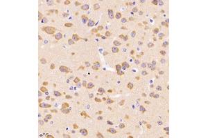 Immunohistochemistry of paraffin embedded mouse brain using CRMP3 (ABIN7073734) at dilution of 1:650 (400x lens)