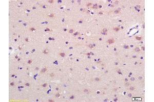 Formalin-fixed and paraffin embedded rat brain labeled with Anti-GRP75 Polyclonal Antibody, Unconjugated (ABIN686992) at 1:200 followed by conjugation to the secondary antibody and DAB staining. (HSPA9 anticorps  (AA 561-679))