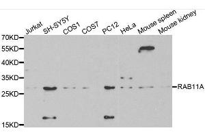 Western blot analysis of extracts of various cell lines, using RAB11A antibody. (RAB11A anticorps  (AA 1-216))