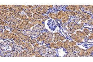 Detection of PIK3Cb in Human Kidney Tissue using Polyclonal Antibody to Phosphoinositide-3-Kinase Catalytic Beta Polypeptide (PIK3Cb)