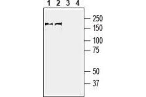 Western blot analysis of rat (lanes 1 and 3) and mouse (lanes 2 and 4) brain membranes: - 1,2.