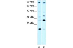 Western Blotting (WB) image for anti-Poly (ADP-Ribose) Polymerase Family, Member 11 (PARP11) antibody (ABIN2460805) (PARP11 anticorps)