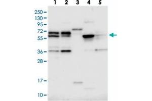 Western blot analysis of Lane 1: RT-4, Lane 2: U-251 MG, Lane 3: Human Plasma, Lane 4: Liver, Lane 5: Tonsil with C15orf52 polyclonal antibody  at 1:250-1:500 dilution. (C15ORF52 anticorps)