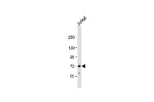 Anti-ZFP36 Antibody (Center) at 1:1000 dilution + Jurkat whole cell lysate Lysates/proteins at 20 μg per lane. (ZFP36 anticorps  (AA 119-148))