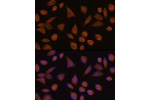 Immunofluorescence analysis of L929 cells using CRYZ Rabbit pAb  at dilution of 1:100 (40x lens). (CRYZ anticorps  (AA 1-329))