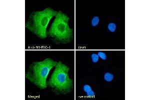 (ABIN570720) Immunofluorescence analysis of paraformaldehyde fixed A549 cells, permeabilized with 0. (CTAG1B anticorps  (Internal Region))