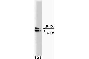 Western blot analysis of COMT on a rat pituitary lysate.