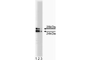 Western blot analysis of COMT on a rat pituitary lysate. (COMT anticorps  (AA 26-141))