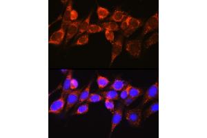 Immunofluorescence analysis of NIH-3T3 cells using Raf1 Rabbit pAb (ABIN3020712, ABIN3020713, ABIN3020714 and ABIN6213686) at dilution of 1:100 (40x lens). (RAF1 anticorps  (AA 190-350))