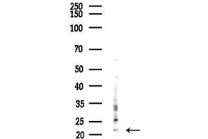 Western blot analysis of lysates from K562 cells(UV, 30 min treatment), using MRPS17 Antibody at 1/1000 dilution.
