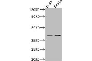 Western Blot Positive WB detected in: U-87 whole cell lysate, Rat Brain whole cell lysate All lanes: NGF antibody at 1:1000 Secondary Goat polyclonal to rabbit IgG at 1/50000 dilution Predicted band size: 27 kDa Observed band size: 39 kDa (Recombinant Nerve Growth Factor anticorps)
