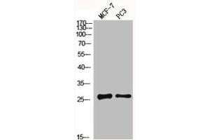 Western Blot analysis of MCF7 PC3 cells using MGMT Polyclonal Antibody (MGMT anticorps  (N-Term))