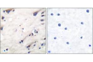Immunohistochemistry analysis of paraffin-embedded human brain tissue, using KSR (Ab-392) Antibody.