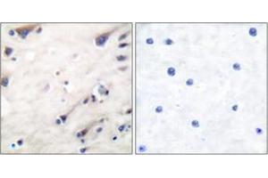 Immunohistochemistry analysis of paraffin-embedded human brain tissue, using KSR (Ab-392) Antibody. (KSR1 anticorps  (AA 358-407))