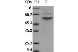 Western Blotting (WB) image for serine/threonine Kinase 24 (STK24) (Active) protein (His tag) (ABIN7317050)