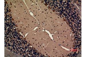 Immunohistochemistry (IHC) analysis of paraffin-embedded Rat Brain, antibody was diluted at 1:100. (CX3CR1 anticorps  (Internal Region))