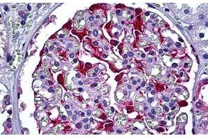 Human Kidney, Glomerulus: Formalin-Fixed, Paraffin-Embedded (FFPE) (S100A6 anticorps  (AA 1-91))