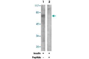 Western blot analysis of extracts from NIH/3T3 cells, treated with Insulin (0. (GRB10 anticorps)